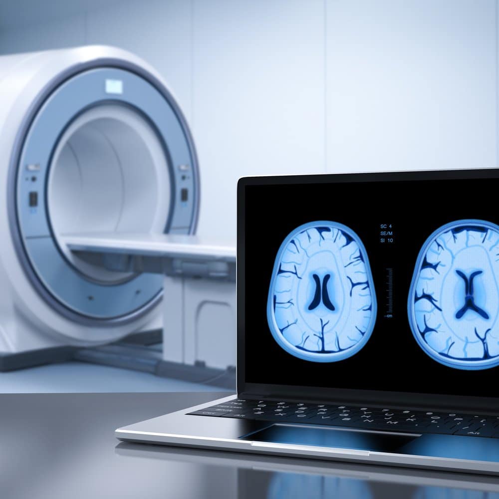 QSIL-Anwendungen-Hochvakuumtechnik